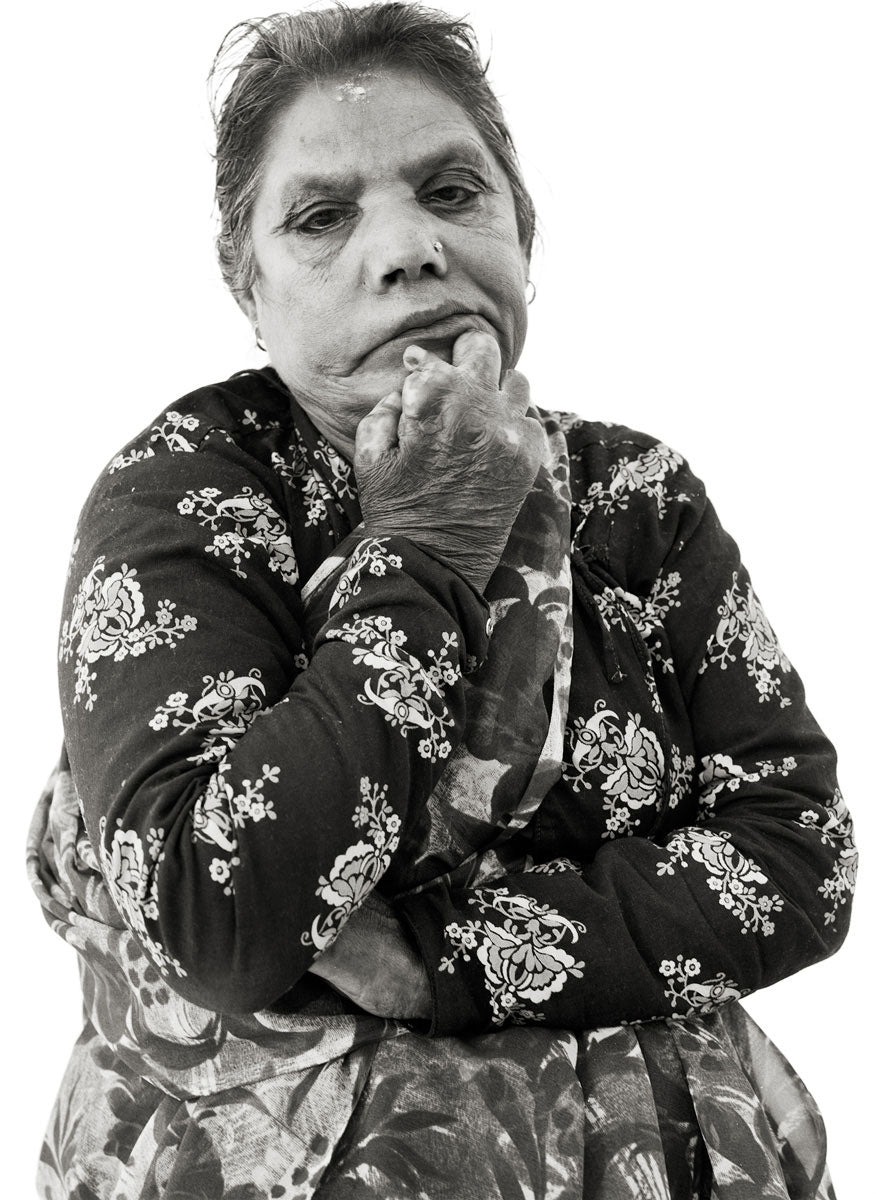 Leprosy XIV